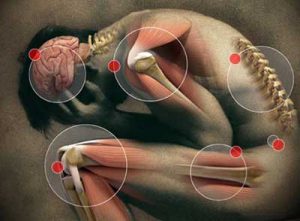 Una quantità eccessiva di acido lattico può causare dolori muscolari