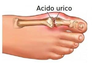 Acido Urico