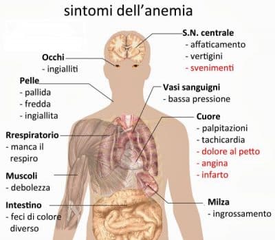 Anemia mediterranea sintomi