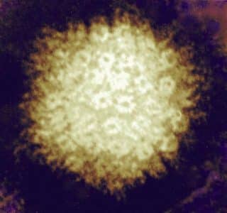 Varicella virus