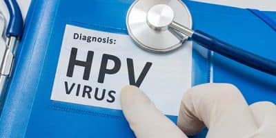 HPV papilloma virus