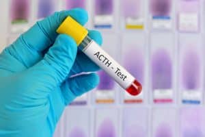 ACT Test act