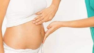 fibroma uterino gravidanza