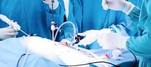 laparoscopia incisioni