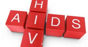 hiv aids